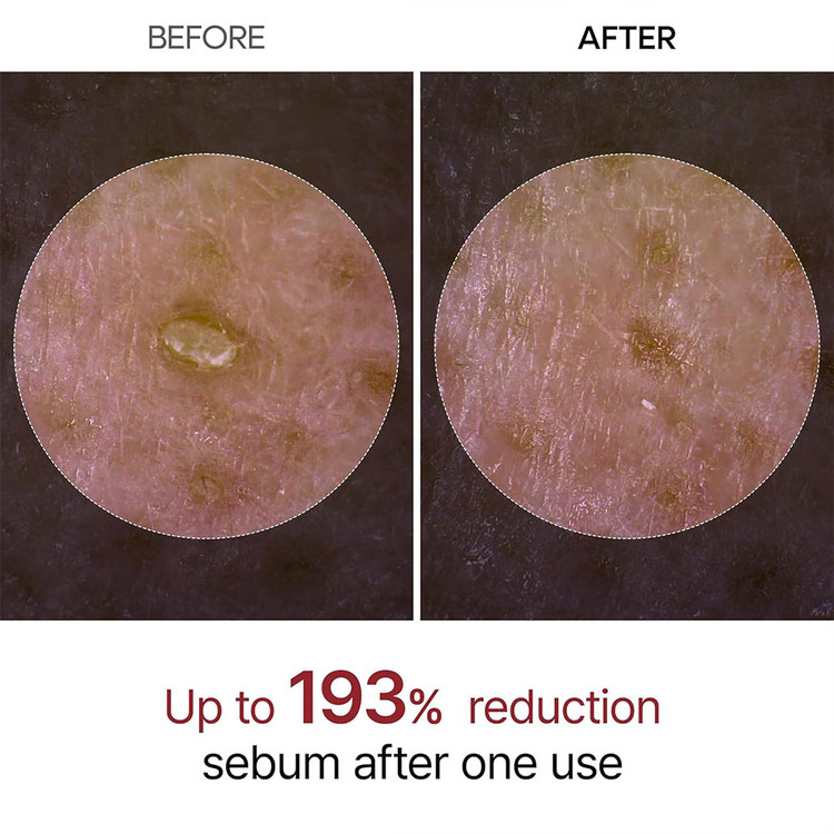 آمپول پیل شات برنج دکتر ملاکسین لایه بردار و روشن کننده پوست