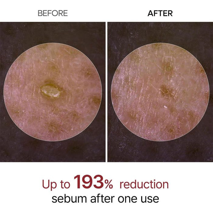 سرم پیل شات برنج سیاه دکتر ملاکسین روشن کننده، لایه بردار و کنترل منافذ پوست