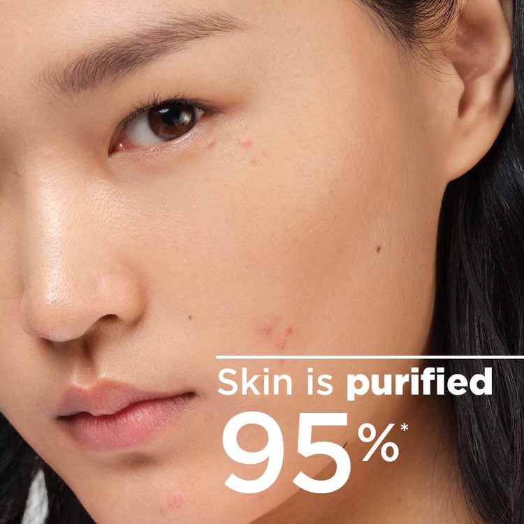 میسلار واتر بایودرما پوست چرب