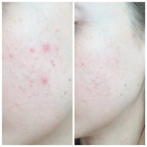 کرم ترمیم کننده سیکاپلاست لاروش پوزای