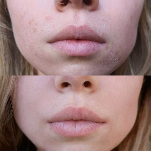 کرم ترمیم کننده سیکاپلاست لاروش پوزای