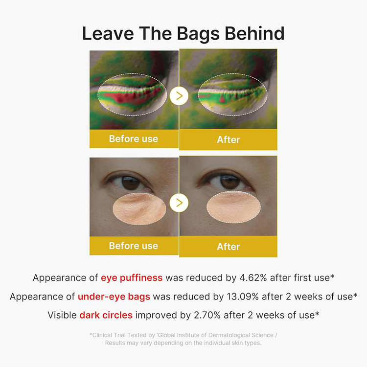 سرم ژلی دور چشم کوجیک اسید و زردچوبه مدی کیوب ضد پف و روشن کننده