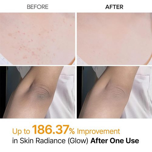 اسپری پیل شات کوجیک اسید دکتر ملاکسین لایه بردار و روشن کننده بدن