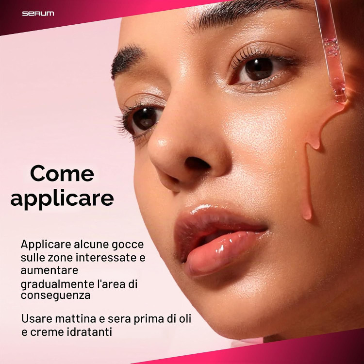 سرم ضد لک نیاسینامید 10% + ترانگزامیک اسید 4% آنوا 50 میل