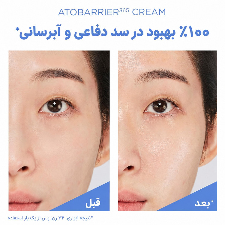 کرم ترمیم کننده و مرطوب کننده قوی اتو بریر 365 استرا Aestura Atobarrier 365 Cream