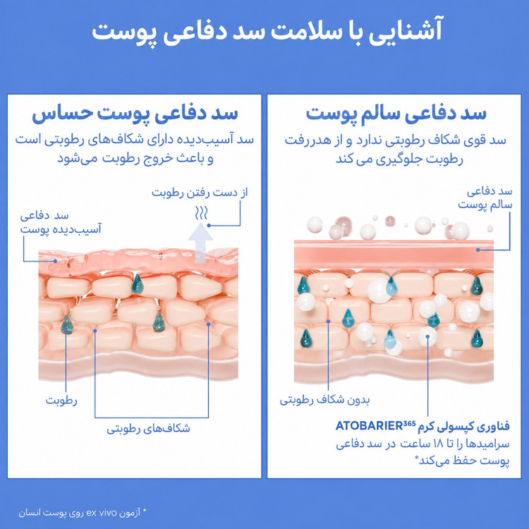 کرم ترمیم کننده و مرطوب کننده قوی اتو بریر 365 استرا Aestura Atobarrier 365 Cream