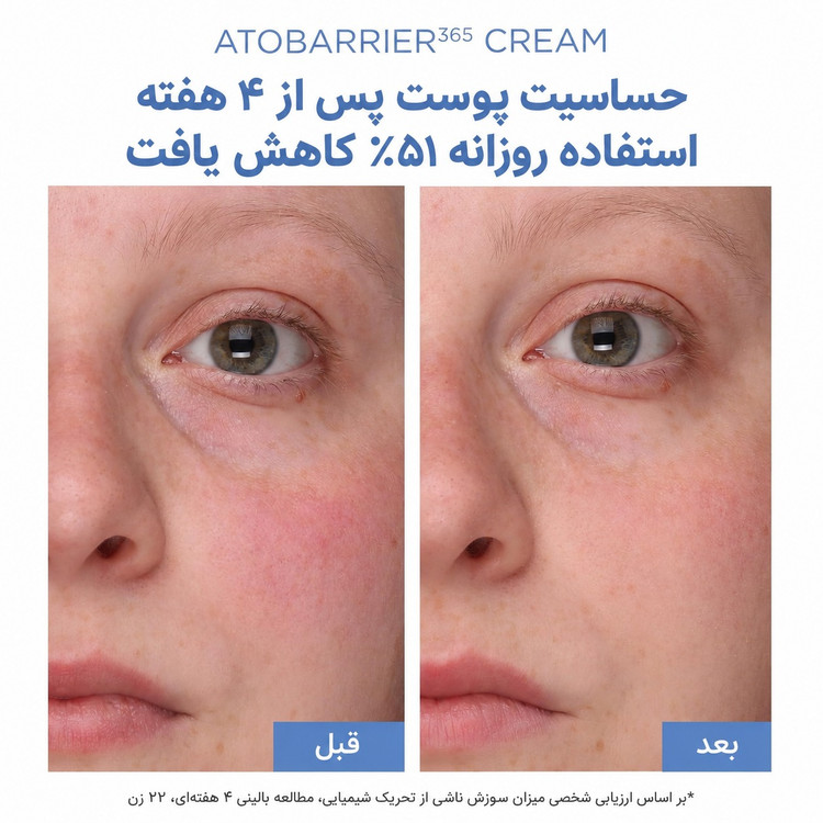 کرم ترمیم کننده و مرطوب کننده قوی اتو بریر 365 استرا Aestura Atobarrier 365 Cream