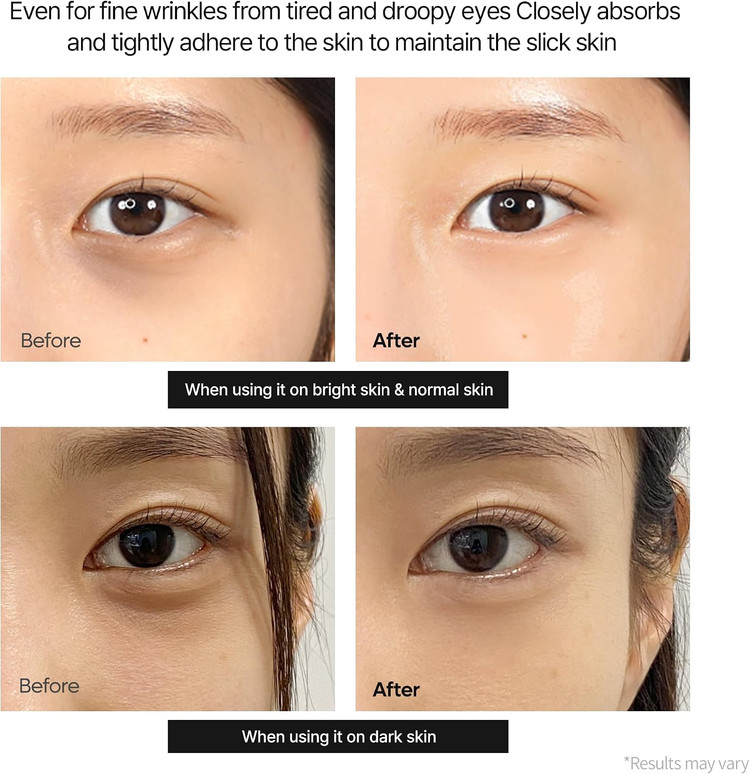 کرم دور چشم کلسیم دارک اسپات دکتر ملاکسین ضد چروک و روشن کننده قوی Dr. Melaxin Cemenrete Calcium Dark Spot Correcting Eye Cream