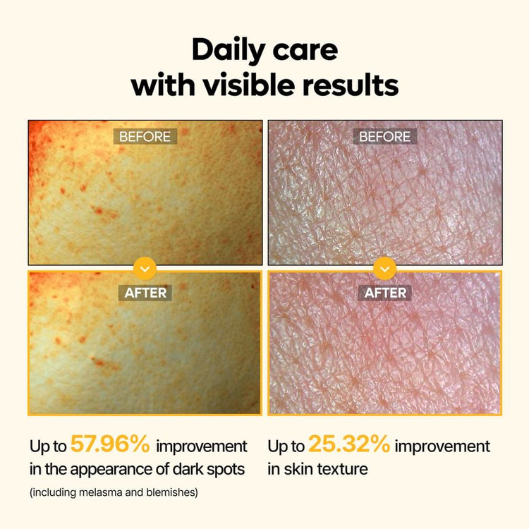 تونر روشنکننده و ضدلک کوجیک اسید و زردچوبه دکتر ملاکسین Dr.Melaxin Kojic Acid Turmeric Toner
